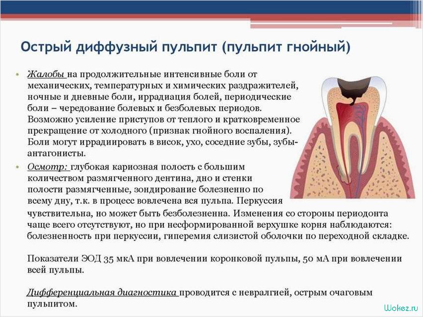 Кариес зуба: лечение в зубной клинике
